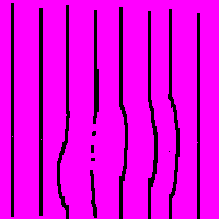 distortion of sight